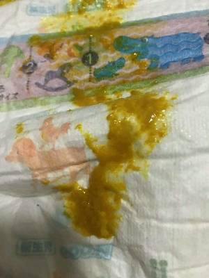 满月宝宝正常大便图片