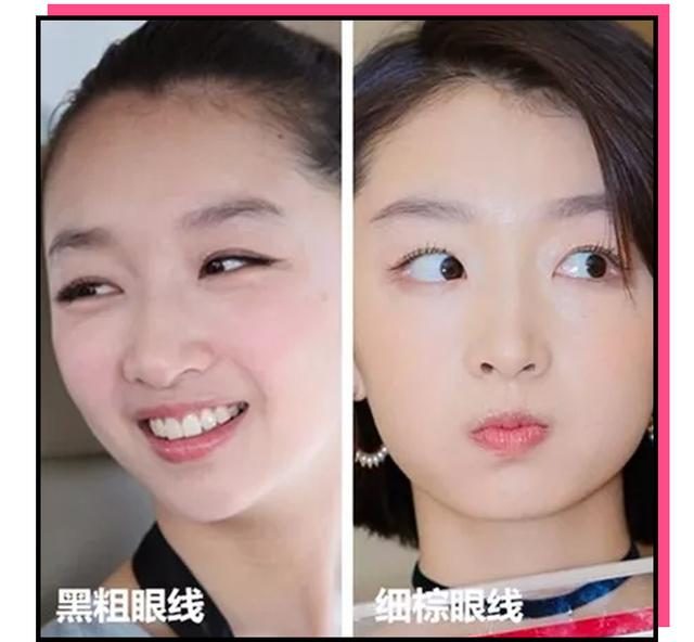 双眼皮就剩睫毛根部肿