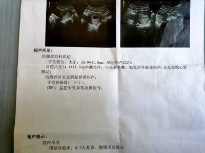 流产多久能怀孕