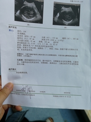 怀孕可以输氨基酸吗
