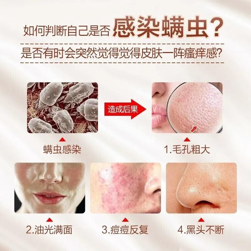 痘痘男護膚哪個好