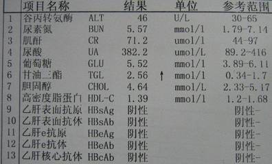 谷转氨酶高是怎么回事