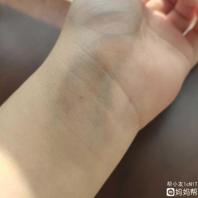 脚发软是怎么回事
