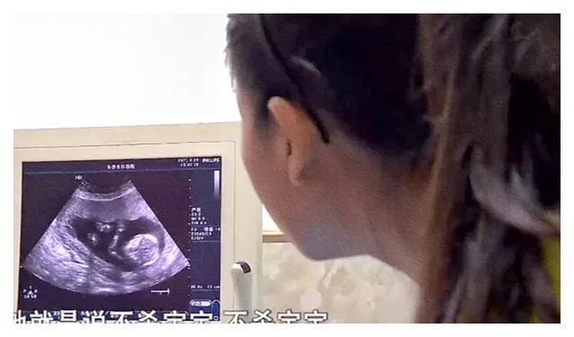 怀孕多久孩子成型