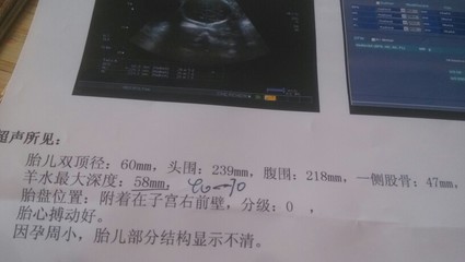 怀孕25周胎儿有多大