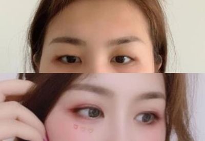 割双眼皮影响运气吗
