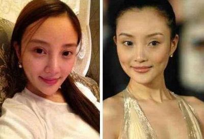 割双眼皮成功的明星