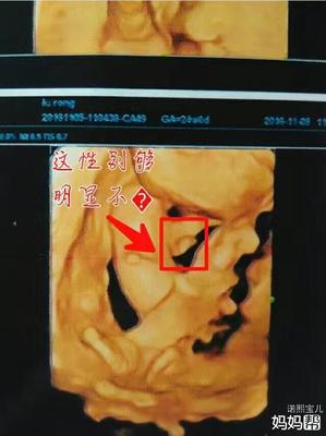 孕妇可以吃姑娘吗