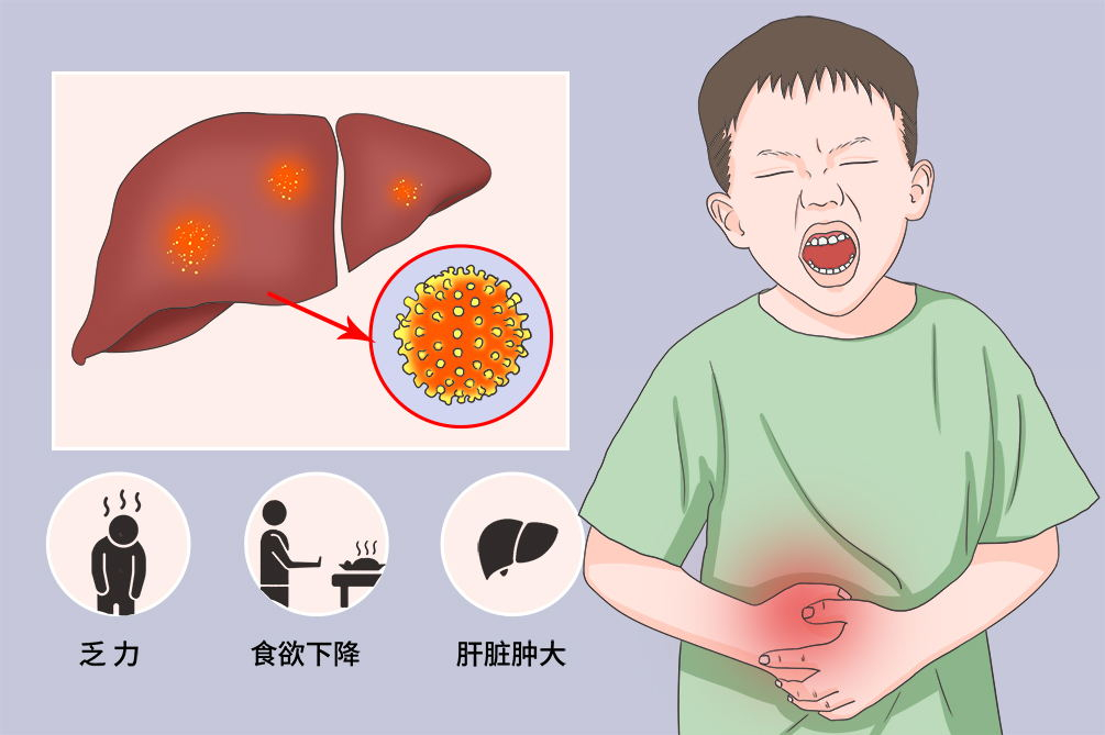 肝炎怎么治疗最好的方法