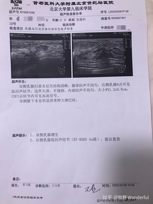 乳腺低回声结节是怎么回事