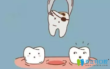 拔牙多久可以好