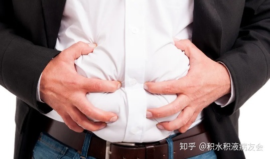 腹胀如鼓是怎么回事