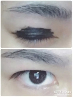 老贴双眼皮贴会怎么样