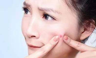 脸上长痘痘应吃什么维生素