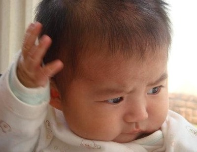 头部出汗多怎么治疗