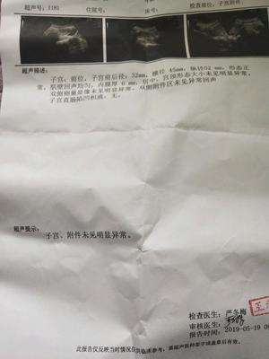 生化之后容易怀孕是真还是假的