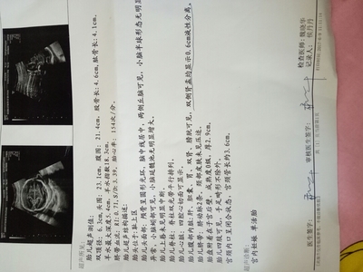 怀孕多久做nt和唐筛