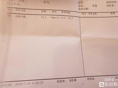 胆汁酸高怎么治疗