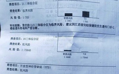 孕妇唐氏筛查临界风险