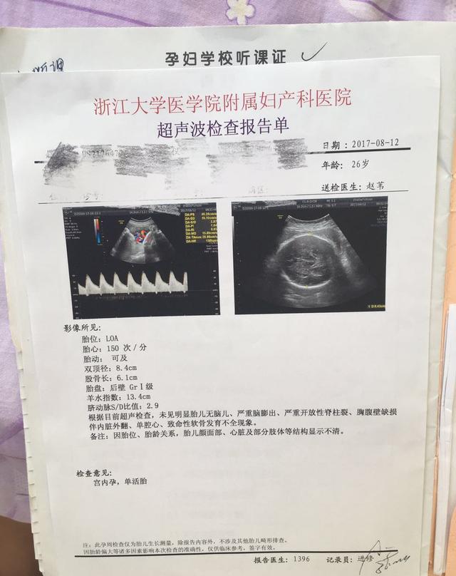 孕妇32周做什么检查