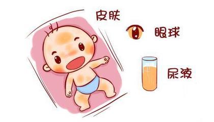 小儿黄疸值正常是多少正常