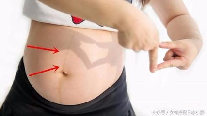 宝宝肚子上有一条竖线