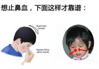 宝宝鼻子出血怎么止血