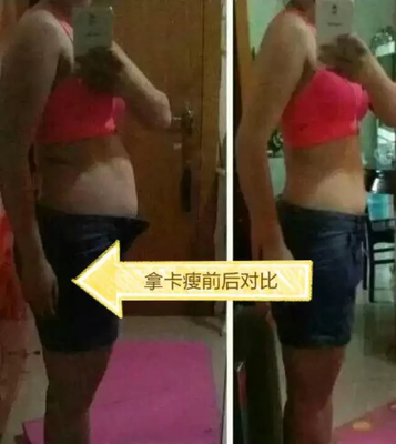 抽脂减肥效果怎么样
