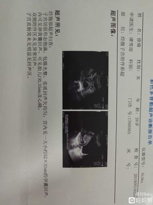 怀孕了怎么看男女