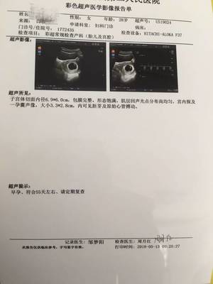 怀孕3个月胎儿多大