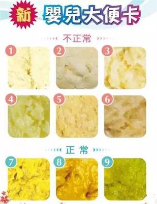 宝宝便便颜色