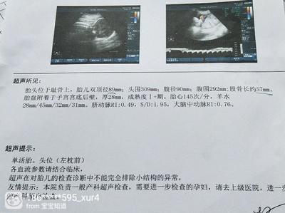 36周胎心率要多少算正常吗