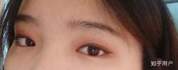 单眼皮变内双