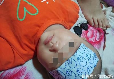 3个月的婴儿发烧怎么办