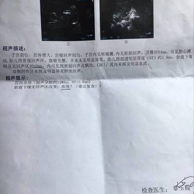 怀孕3个月胎儿多大