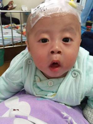 七个月宝宝反复发烧怎么办