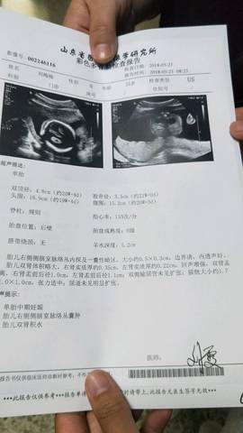 引产胎儿是活的吗