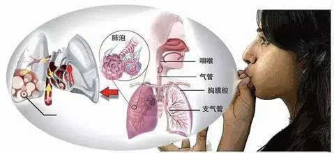 早晨起床咳嗽痰多是怎么回事