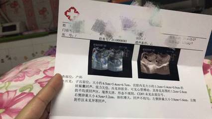 无优势卵泡竟然怀孕了