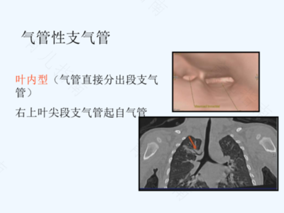 气道狭窄怎么治疗
