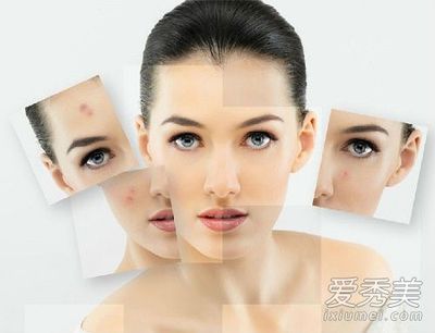 为啥老长痘痘