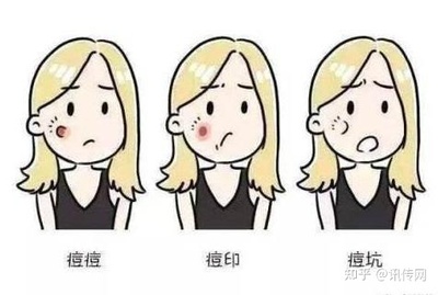 怎样才能淡化痘印