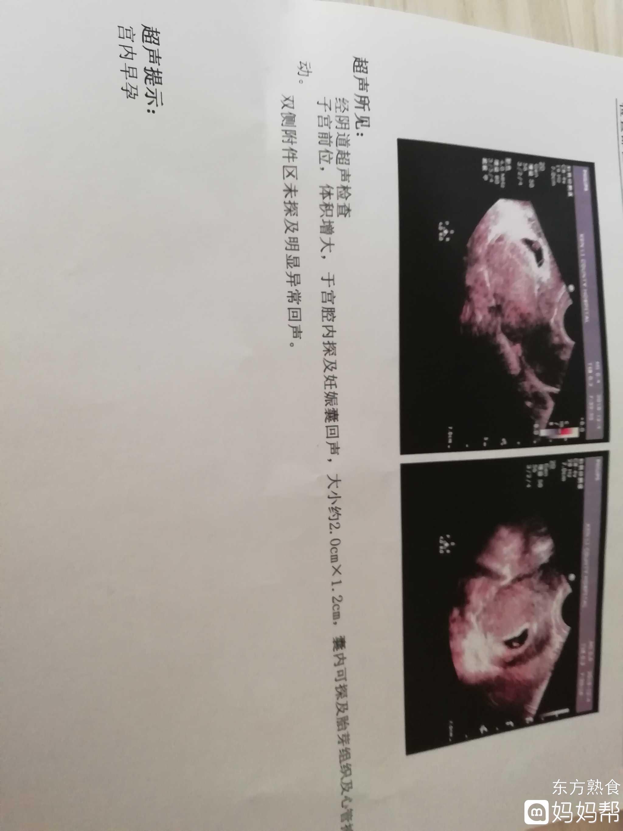 怀孕几个月可以看到胎心