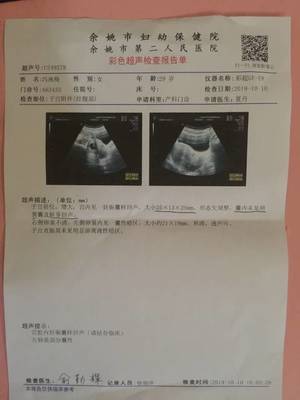 怀孕14周宝宝有多大