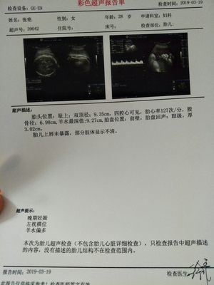 孕38加5周羊水多少为正常