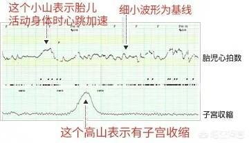 几个月做胎心监护