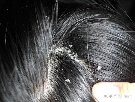 洗面奶多久换一次牌子