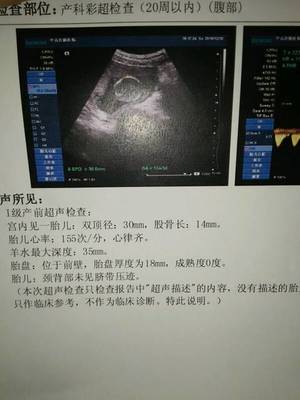 二十周的胎儿有多大