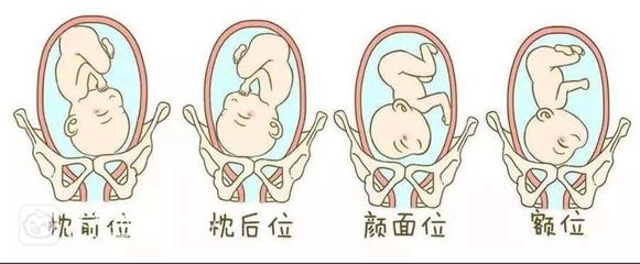 宝宝在肚子里什么姿势