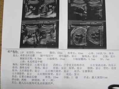孕妇需要做心脏彩超吗